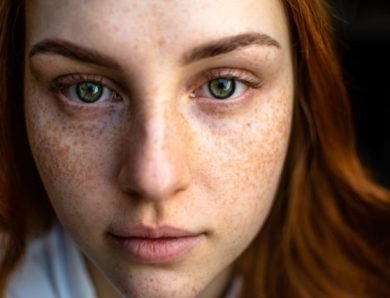 Comprendre l’hyperpigmentation : routines et solutions efficaces à adopter